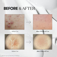VT Cosmetics VT Reedle Shot 100 Serum – Authentic Korean Skincare, Buy in UAE