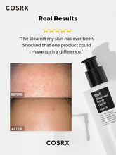 COSRX BHA Blackhead Power Liquid 100ml How to Use – Korean Skincare Arabia UAE