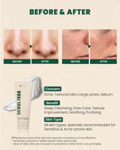 K-SECRET Seoul 1988 Pine Cica Cleansing Foam 150ml – Authentic Korean Skincare, Buy in UAE