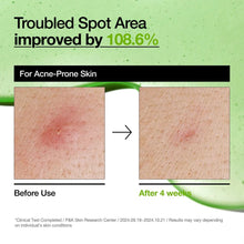 ANUA Azelaic Acid 10 Hyaluron Redness Soothing Serum 30ml – Authentic Korean Skincare, Buy in UAE