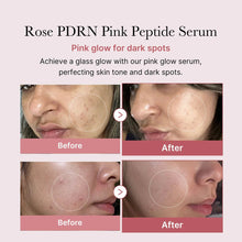 Medicube PDRN Pink Peptide Serum 30ml – Authentic Korean Skincare, Buy in UAE