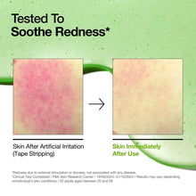ANUA Azelaic Acid 10 Hyaluron Redness Soothing Serum 30ml How to Use – Korean Skincare Arabia UAE